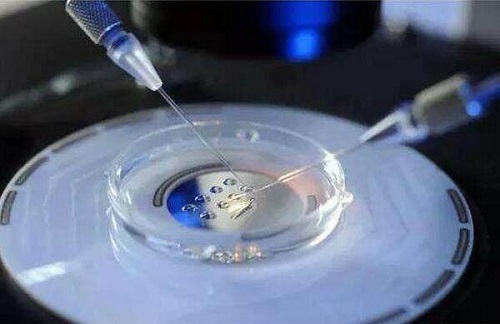 美国试管婴儿深度剖析：关于赴美IVF的4个疑问