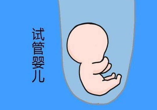 做美国试管婴儿前 这些都是你应该知道的