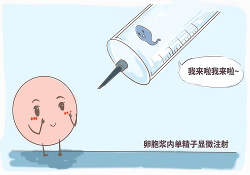 去美国做试管婴儿，避免导致IVF失败的四个原因