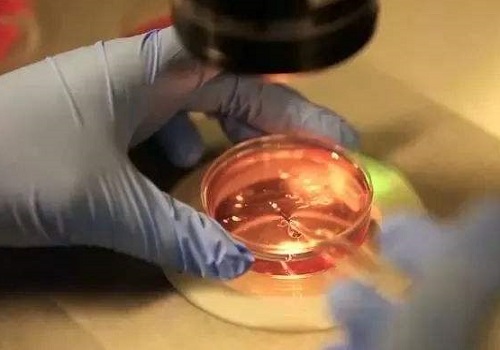 去美国做试管婴儿的价格预算清单