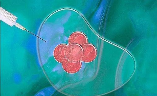 去美国做试管婴儿物超所值 六个方面价值体现